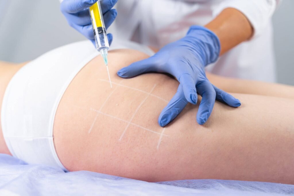 Fat-dissolving injection treatment on the thigh