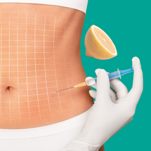 Lipolysis injections